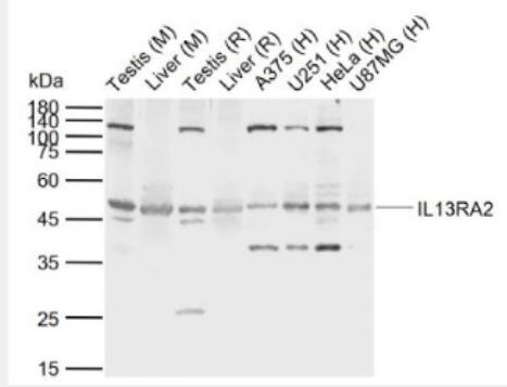 Anti-IL13RA2 antibody-白细胞介素13受体a2抗体