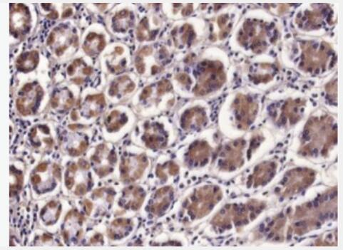 Anti-IL-17B antibody-白介素-17B抗体