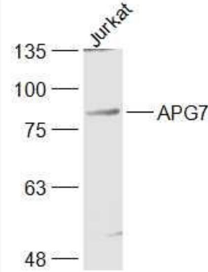 Anti-ATG7/APG7  antibody-自噬相关蛋白7抗体