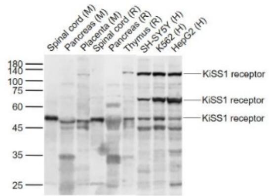 Anti-KiSS1 receptor antibody-G蛋白偶联受体54抗体