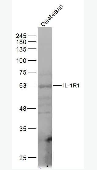 Anti-IL-1R1 antibody-白介素1受体1抗体