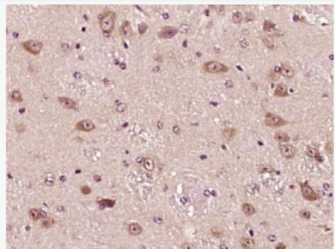 Anti-IL22BP antibody-白介素22受体结合蛋白抗体