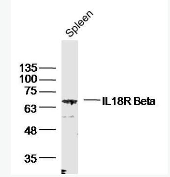 Anti-IL18R Beta antibody-白细胞介素-18受体β链抗体