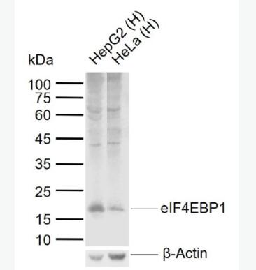 Anti-eIF4EBP1 antibody-eIF4E结合蛋白抗体