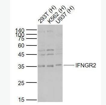 Anti-IFNGR2 antibody-干扰素-gamma受体2/干扰素-gamma受体β/IFN-γRβ抗体