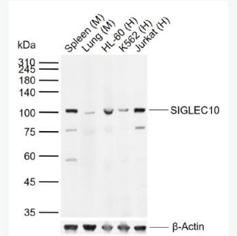 Anti-SIGLEC10 antibody-肿瘤坏死因子配体超家族成员14抗体