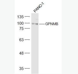 Anti-GPNMB antibody-GPNMB抗体