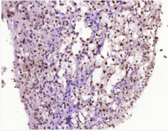 Anti-TNFAIP3 antibody-肿瘤坏死因子α诱导蛋白3抗体