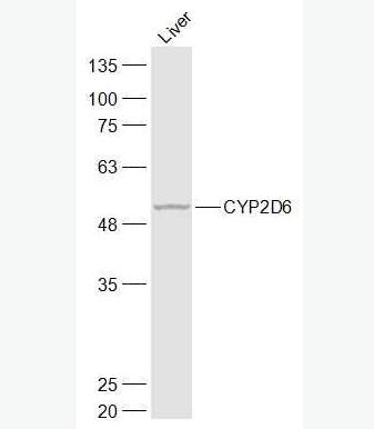 Anti-CYP2D6 antibody-细胞色素P450 2D6抗体