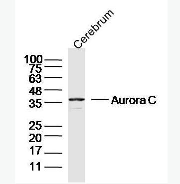 Anti-Aurora C antibody-有丝分裂激酶B抗体