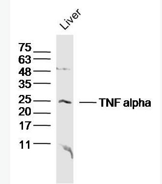 Anti-TNF alpha antibody-肿瘤坏死因子-α/TNFα抗体