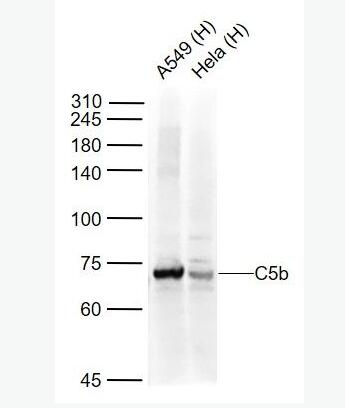 Anti-C5b-9 antibody-末端补体复合物抗体