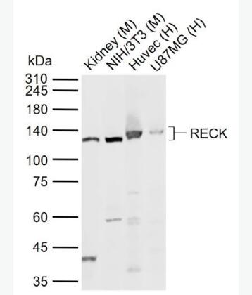 Anti-RECK antibody-金属蛋白酶抑制因子RECK抗体