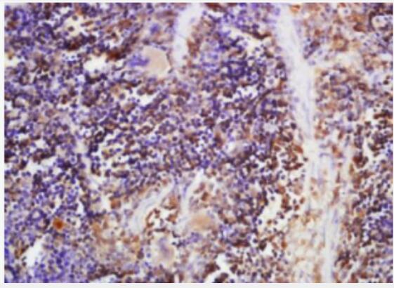 Anti-Nucleobindin 2 antibody-新的饱食分子蛋白抗体