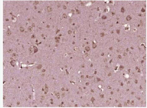 Anti-mu Opioid receptor antibody-μ-型阿片受体抗体