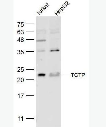 Anti-TCTP antibody-翻译控制肿瘤蛋白抗体