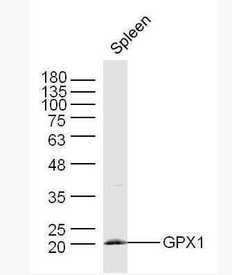 Anti-GPX1 antibody-谷胱甘肽过氧化酶1