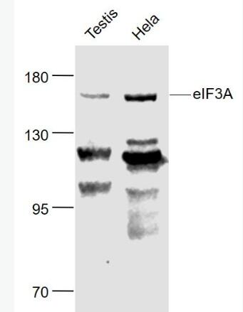 Anti-eIF3A antibody-真核翻译起始因子3A抗体