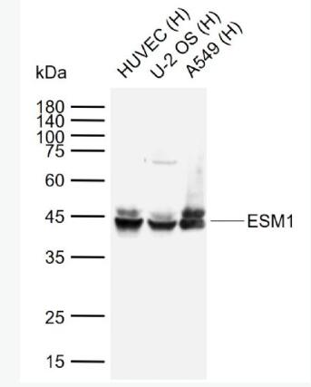 Anti-ESM1 antibody-内皮细胞特异性分子1抗体