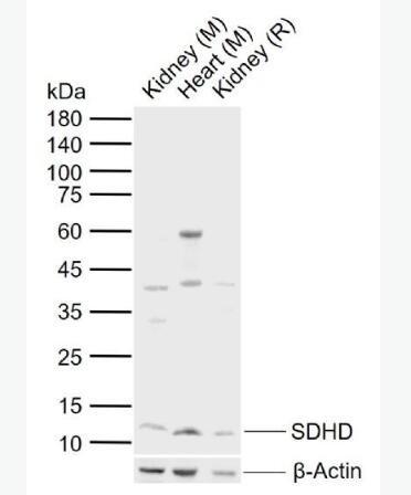 Anti-SDHD antibody-线粒体琥珀酸脱氢酶D抗体