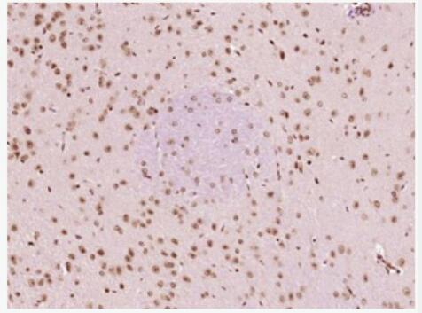 Anti-HSF1  antibody-热休克因子1抗体