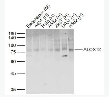 Anti-ALOX12 antibody-12脂氧合酶抗体