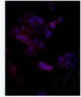 Anti-LRP2 antibody-糖蛋白gp330抗体