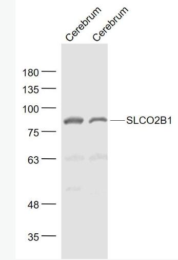 Anti-SLCO2B1 antibody-可溶性载质转运蛋白2B1抗体