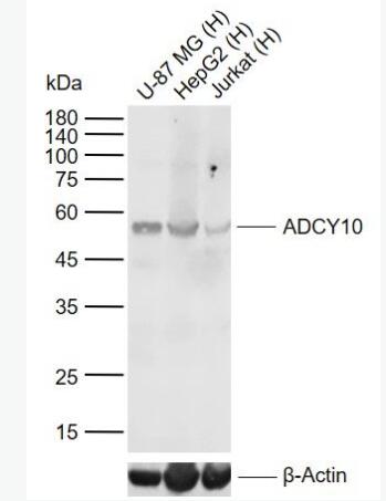 Anti-ADCY10 antibody-腺苷酸环化酶10抗体