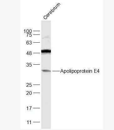 Anti-Apolipoprotein E4 antibody-载脂蛋白E4抗体