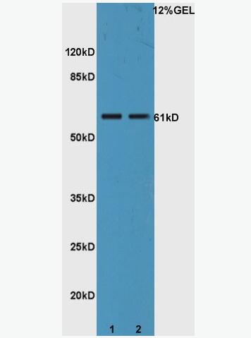 Anti-IL22R antibody-白介素22受体抗体