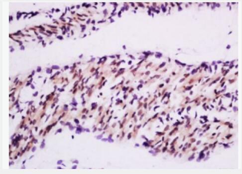 Anti-MuRF1 antibody-肌肉细胞特异性泛素蛋白连接酶1抗体