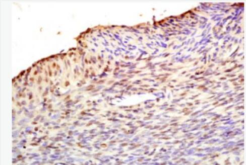 Anti-Fbx32 antibody-泛素蛋白连接酶抗体