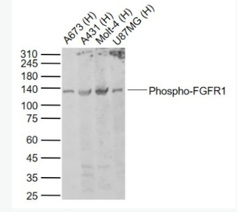 Anti-Phospho-FGFR1 (Tyr154) antibody-磷酸化碱性成纤维细胞生长因子受体1（CD331）抗体