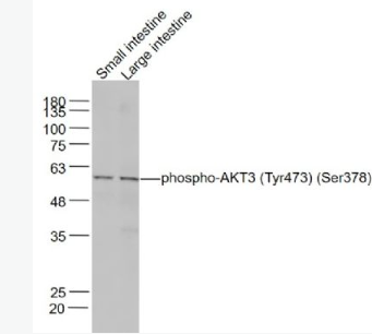 Anti-phospho-AKT3 (Tyr473) antibody-磷酸化蛋白激酶B抗体