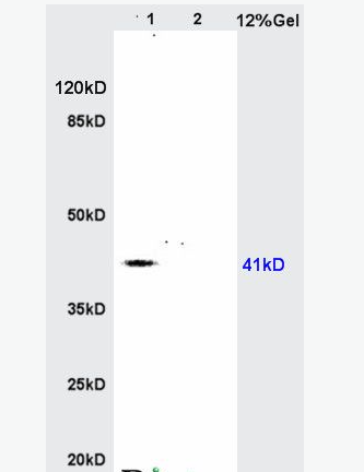 Anti-AGPAT4 antibody-溶血磷脂酸酰基转移酶D抗体