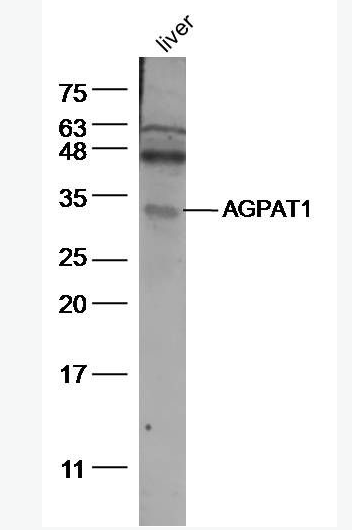 Anti-AGPAT1 antibody-溶血磷脂酰基转移酶抗体