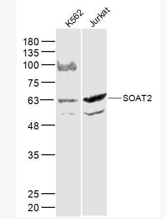 Anti-SOAT2 antibody-胆固醇酰基转移酶2抗体