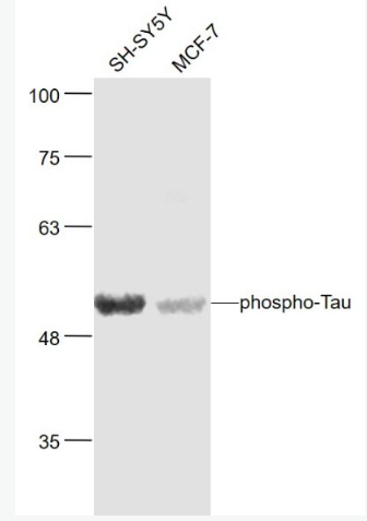 Anti-phospho-Tau (Ser404) antibody-磷酸化微管相关蛋白抗体
