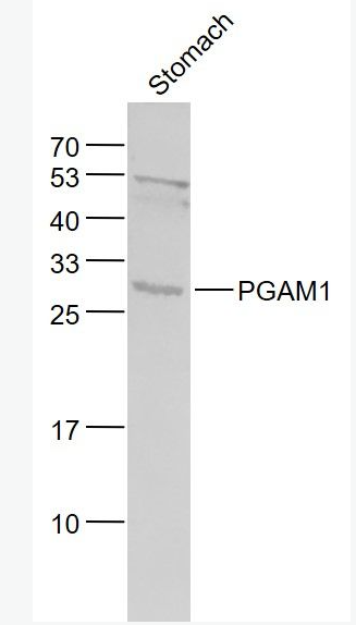 Anti-PGAM1 antibody-磷酸变位酶1抗体