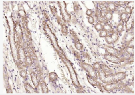 Anti-PFKM/PFK1 antibody-肌肉型6磷酸果糖激酶/磷酸果糖激酶1抗体