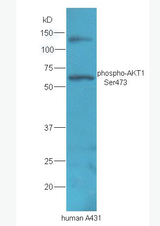 Anti-phospho-AKT1 (Ser473) antibody-磷酸化蛋白激酶AKT1抗体