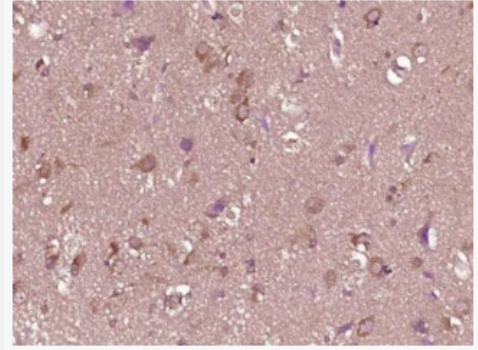 Anti-Phospho-Serine/Threonine antibody-磷酸化丝氨酸/苏氨酸抗体