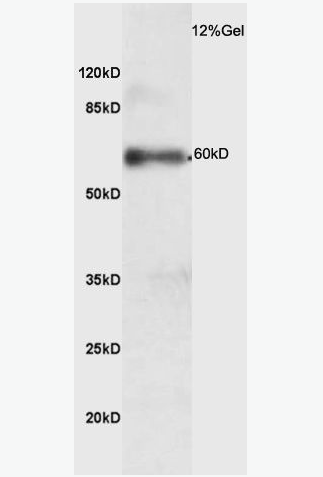 Anti-phospho-IRAK4 (Thr345) antibody-磷酸化白介素-1受体相关激酶4抗体