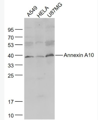 Anti-Annexin A10 antibody-膜粘连蛋白10抗体