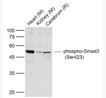 Anti-phospho-Smad3 (Ser423) antibody-磷酸化细胞信号转导分子SMAD3抗体