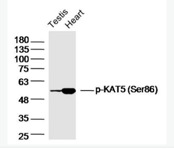 Anti-phospho-KAT5 (Ser86)  antibody-磷酸化组蛋白乙酰转移酶KAT5抗体