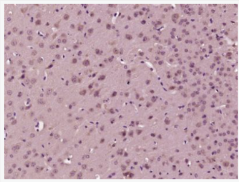 Anti-pphospho-IRS1 (Ser323)  antibody-磷酸化胰岛素受体底物1抗体