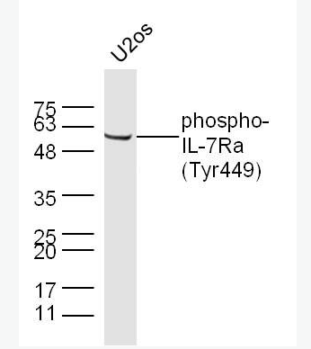 Anti-pphospho-IL7R (Tyr449) antibody-磷酸化白细胞介素-7受体a（CD127）抗体