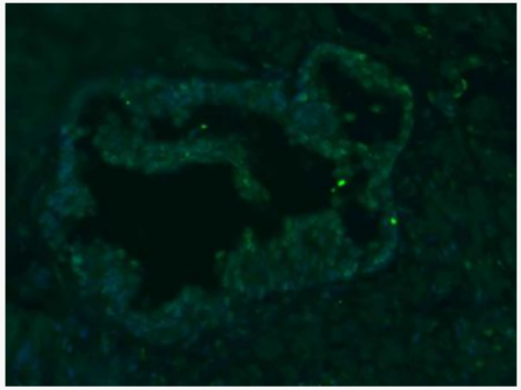 Anti-PLCZ1 antibody-磷酸肌醇磷脂酶PLCZ1抗体